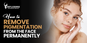 How to remove pigmentation from the face permanently 