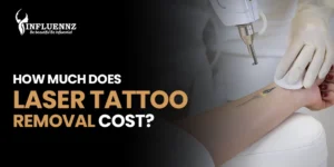 Laser tattoo removal cost in Delhi