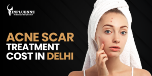 Acne Scar Treatment Cost in Delhi