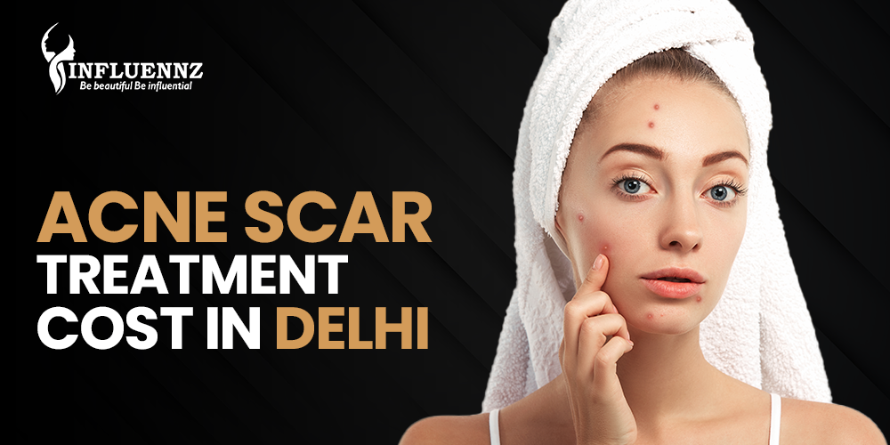Acne Scar Treatment Cost in Delhi