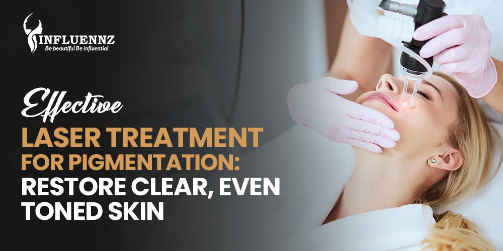 Laser Treatment for Pigmentation