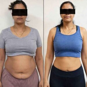 ozempic weight loss treatment in Delhi
