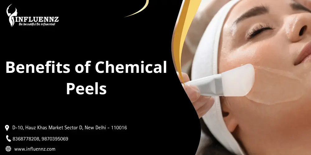 Benefits of Chemical Peels