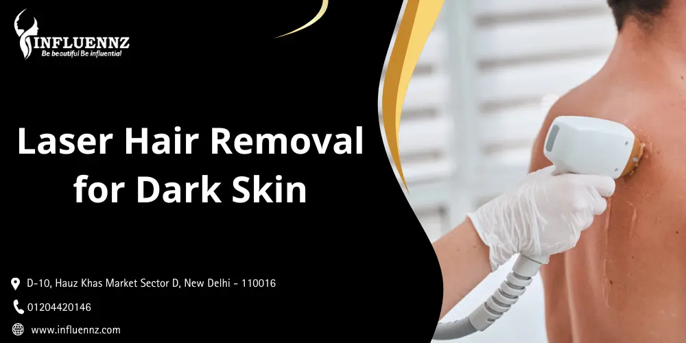 Laser Hair Removal for Dark Skin