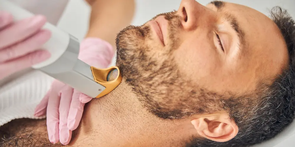 Laser Hair Removal for Men