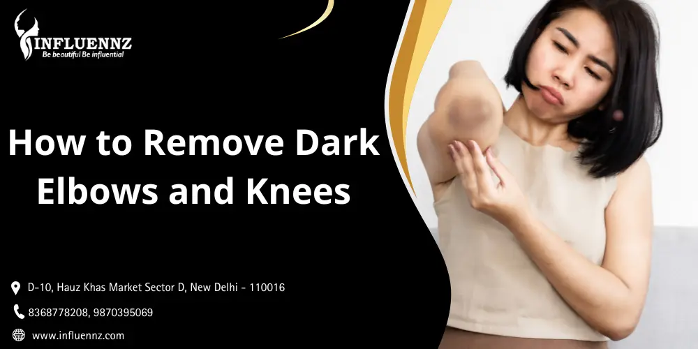 How to Remove Dark Elbows and Knees