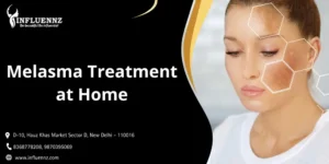 Melasma Treatment at Home