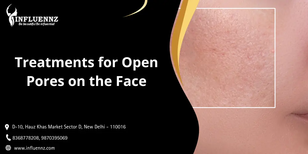 Dermatologist Treatments for Open Pores on Face