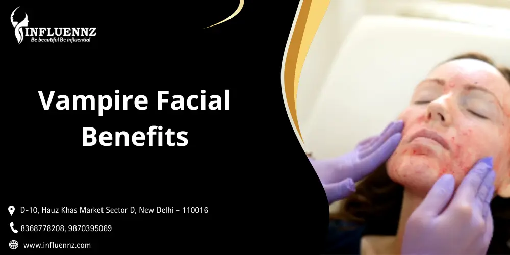Vampire Facial Benefits