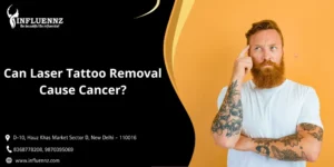 Can Laser Tattoo Removal Cause Cancer
