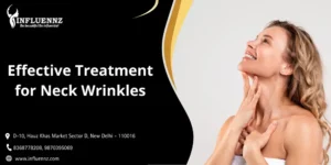 Effective Treatment for Neck Wrinkles