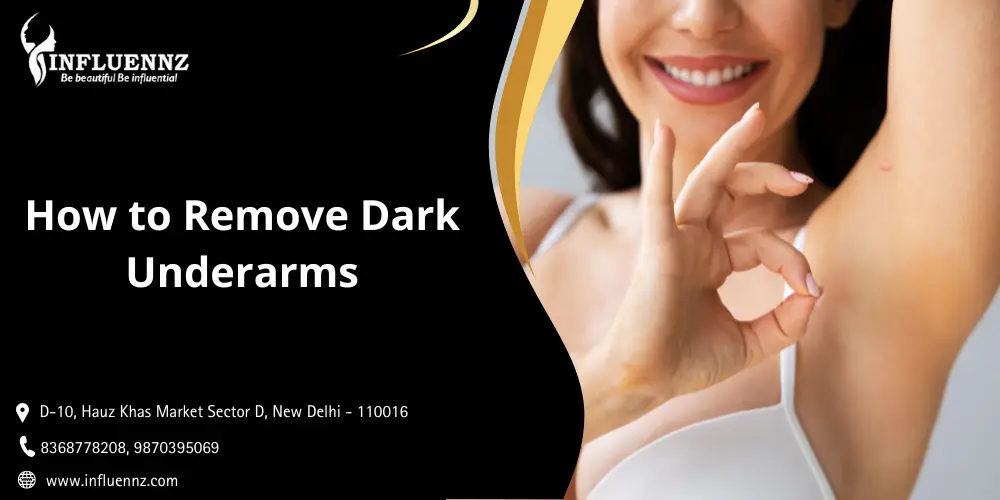 How to Remove Dark Underarms
