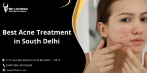Best Acne Treatment in South Delhi