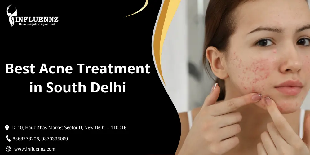 Best Acne Treatment in South Delhi
