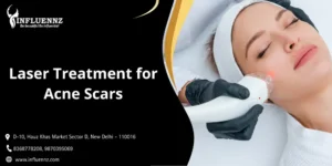 Read more about the article Laser Treatment for Acne Scars: Procedure, Cost, Before & After, and Results