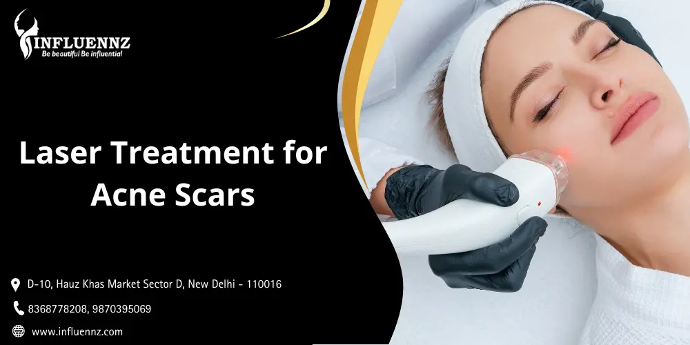 Read more about the article Laser Treatment for Acne Scars: Procedure, Cost, Before & After, and Results