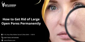 How to Get Rid of Large Open Pores Permanently