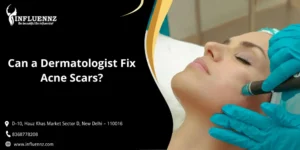 Can a Dermatologist Fix Acne Scars
