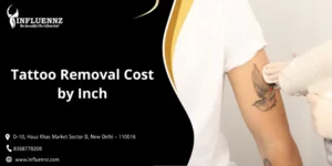 1 inch tattoo removal cost