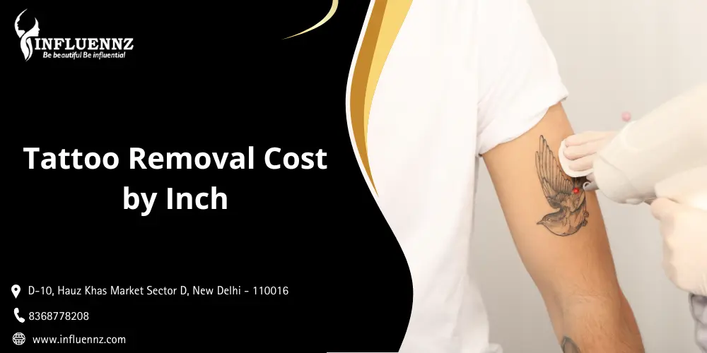 1 inch tattoo removal cost