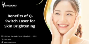 Benefits of Q-Switch Laser for Skin Brightening