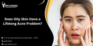 Does Oily Skin Have a Lifelong Acne Problem