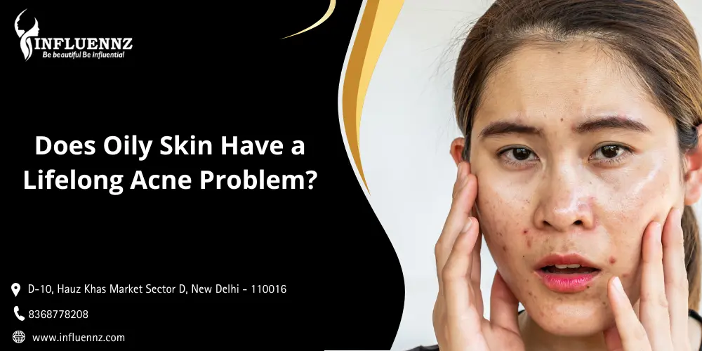 Does Oily Skin Have a Lifelong Acne Problem
