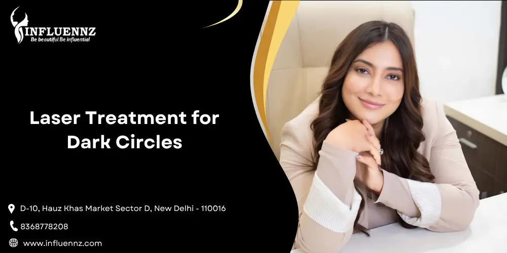 Laser Treatment for Dark Circles