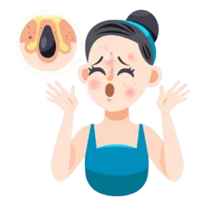 forehead acne treatment