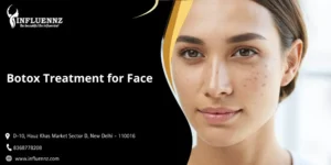 Botox Treatment for Face
