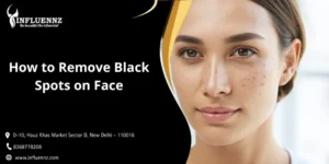 How to Remove Black Spots on Face