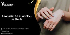 How to Get Rid of Wrinkles on Hands