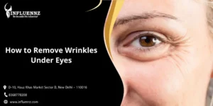 How to Remove Wrinkles Under Eyes