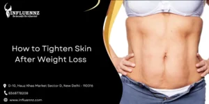 How to Tighten Skin After Weight Loss