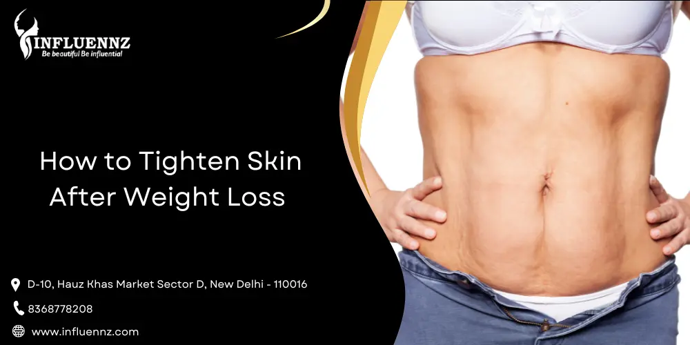 How to Tighten Skin After Weight Loss