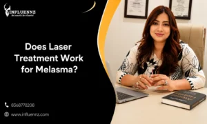 Laser Treatment Work for Melasma