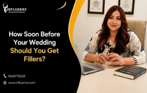 How Soon Before Your Wedding for Fillers
