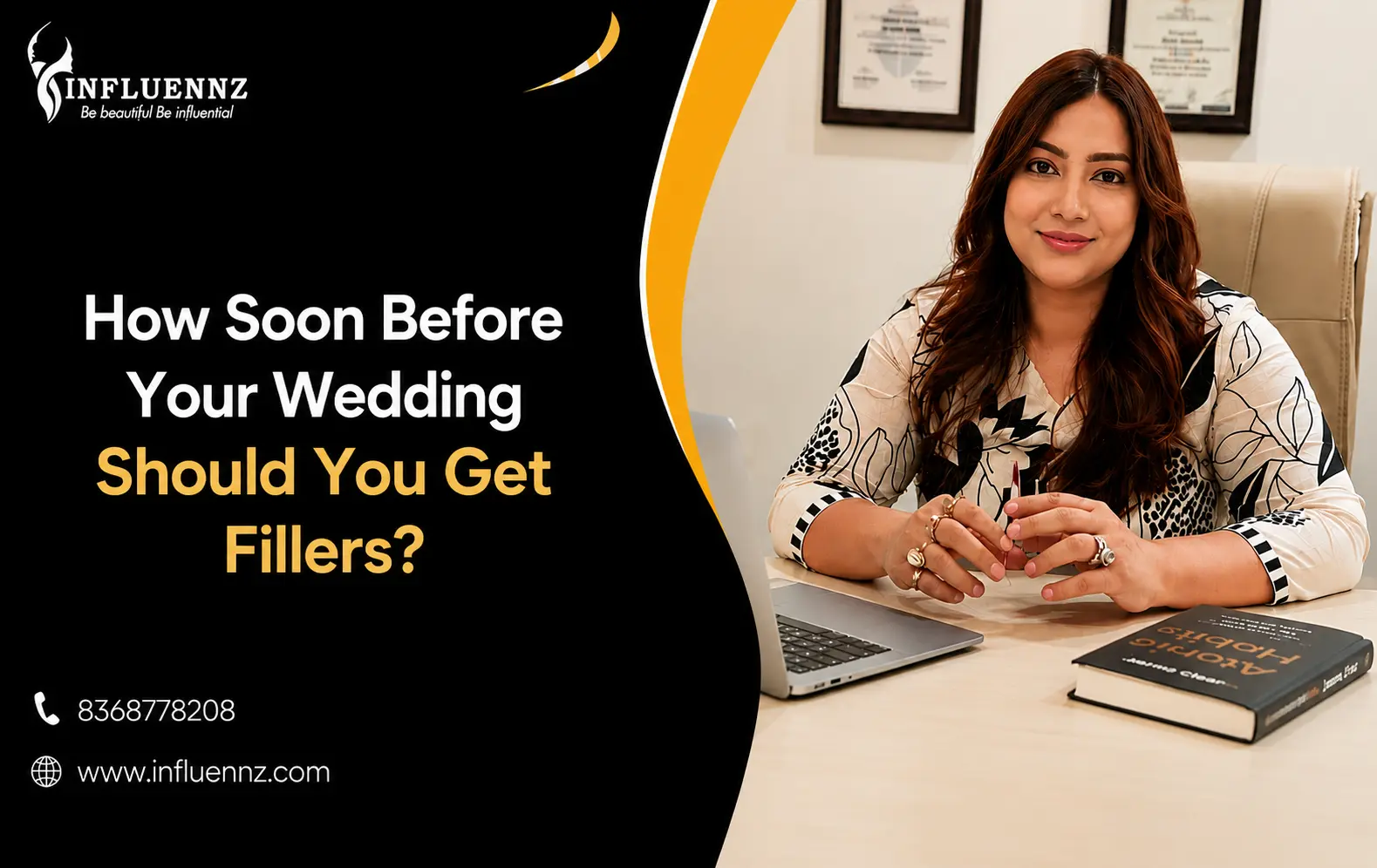 How Soon Before Your Wedding for Fillers