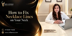 How Can You Fix Necklace Lines