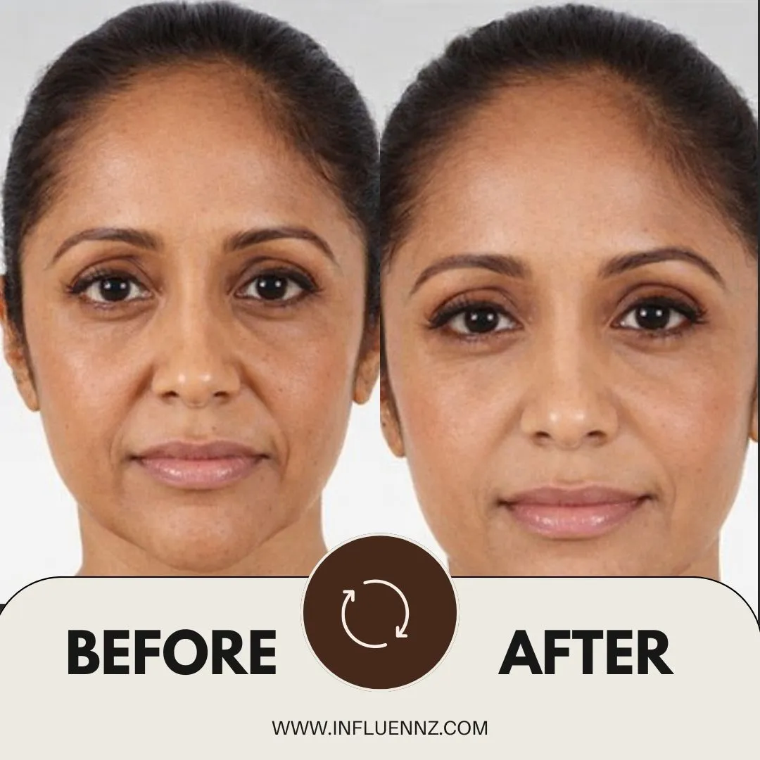 Before and After 1