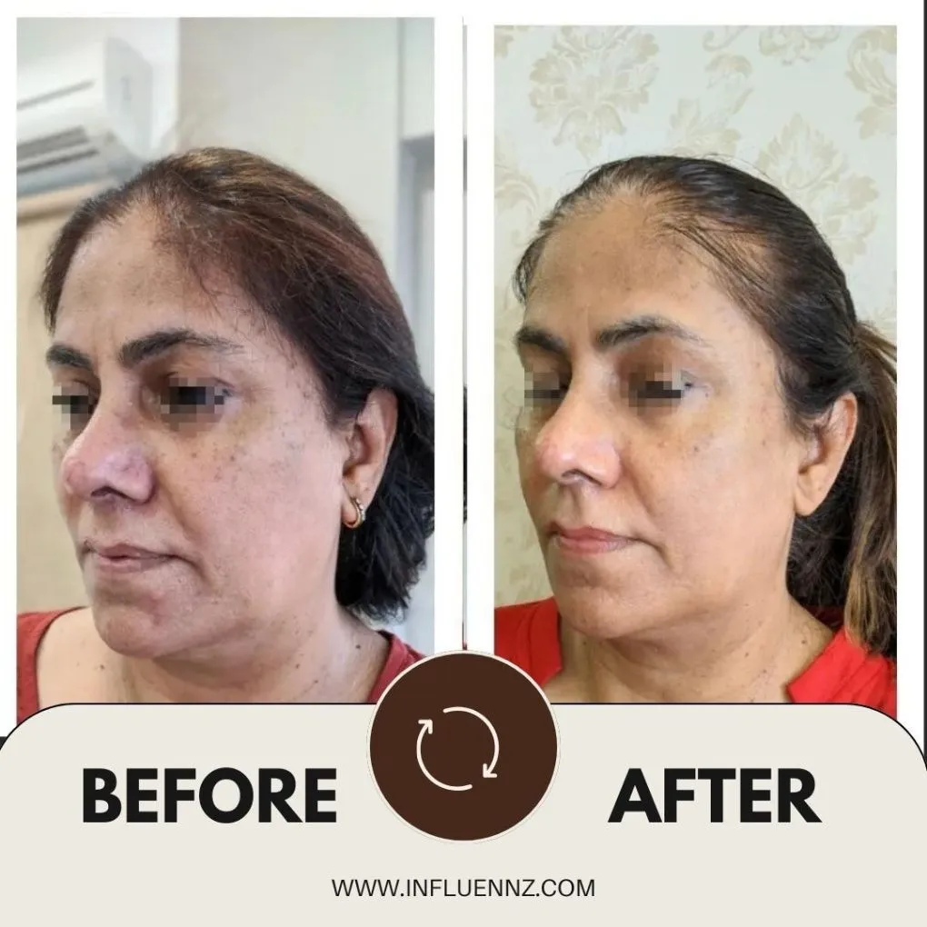 Before and After 2