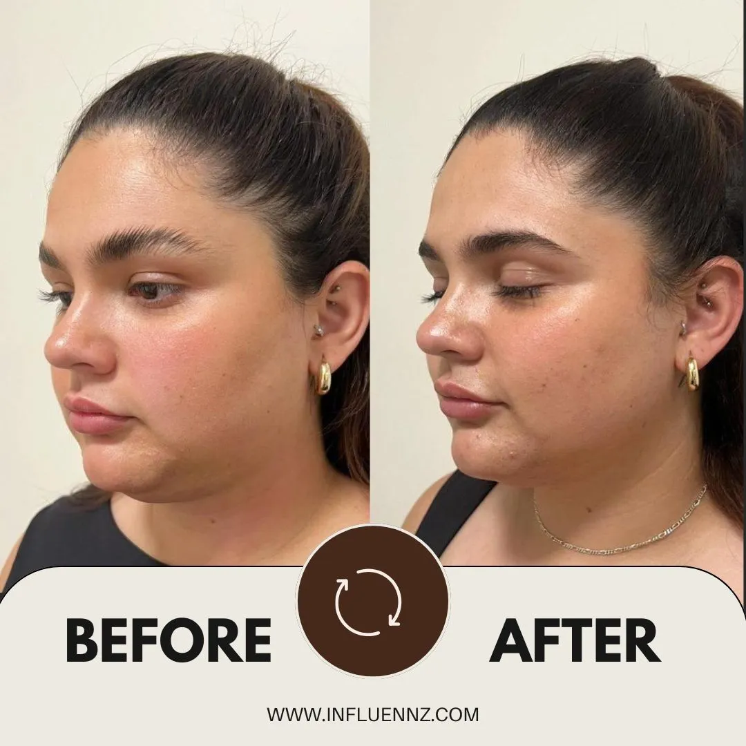 Before and After 3