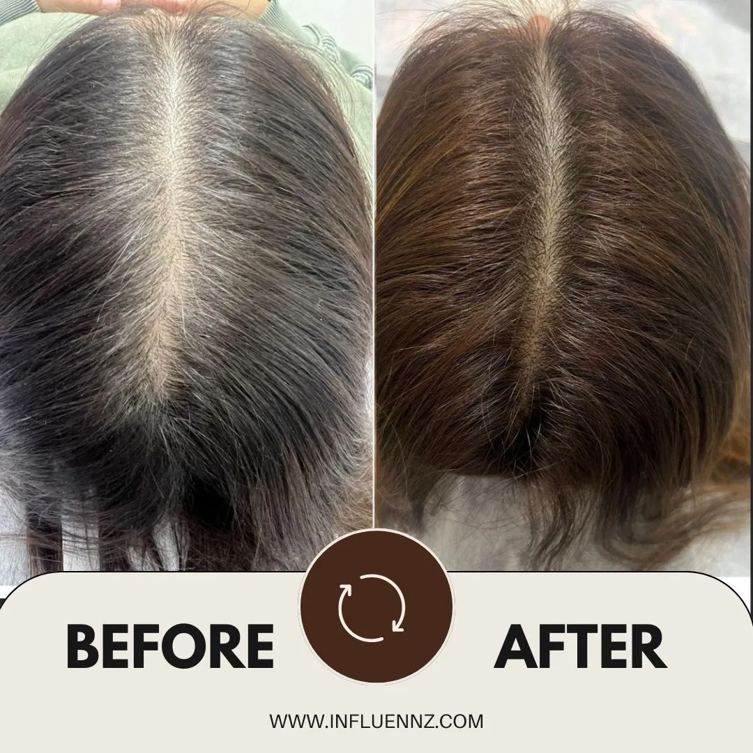 GFC treatment Before and After