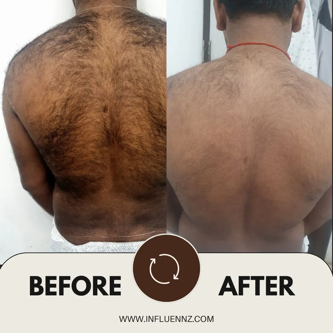 Before and After 1