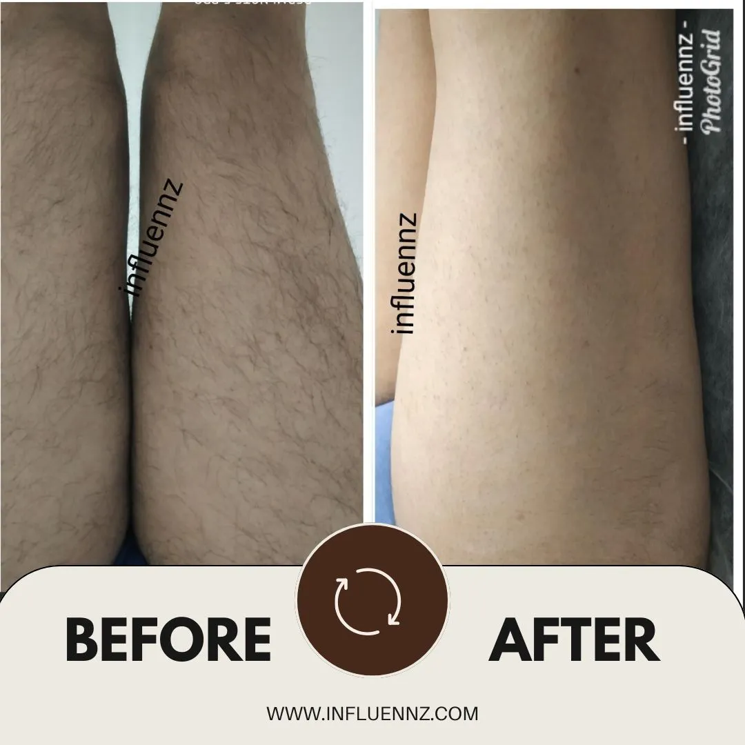 Before and After 2