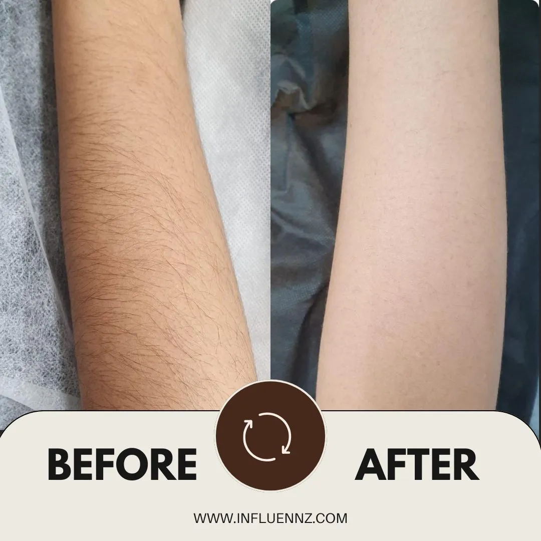 Before and After 3