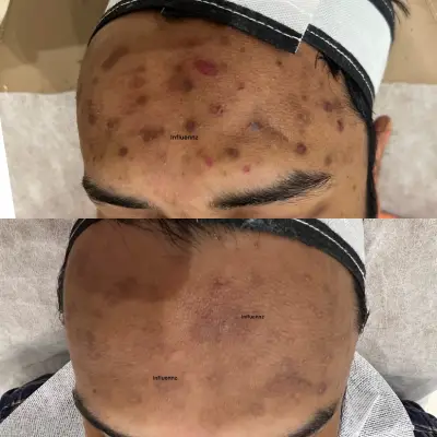 pigmentation