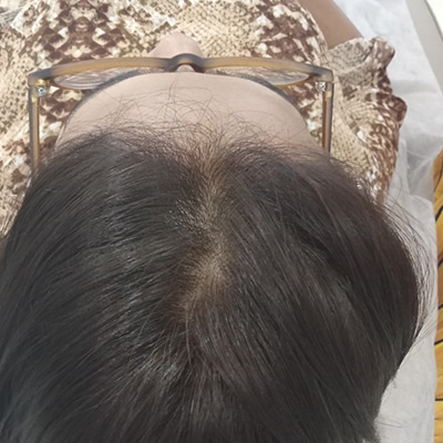 Hair Treatment
