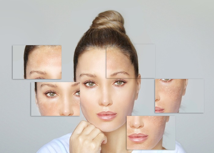 Pigmentation treatment in Delhi