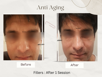 Anti-ageing before and after result